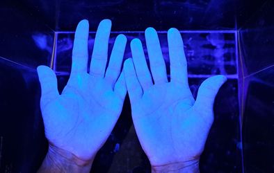 Pravilno razkužene roke.