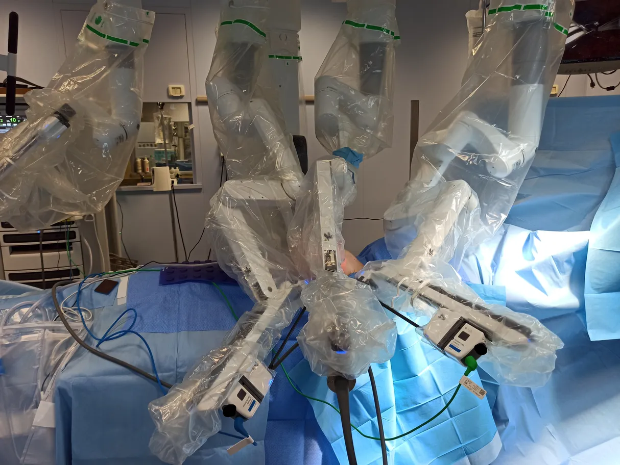 Prvi robotiziran poseg profilaktične mastektomije v deželi Furlaniji-Julijski krajini, ki ga je izvedla ekipa dr. Giuseppeja Stacula.