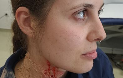 Skupna vaja SB Nova Gorica in PU Nova Gorica za ravnanje v primeru pojava življenja ogrožajočih dogodkov v zdravstveni ustanovi.
