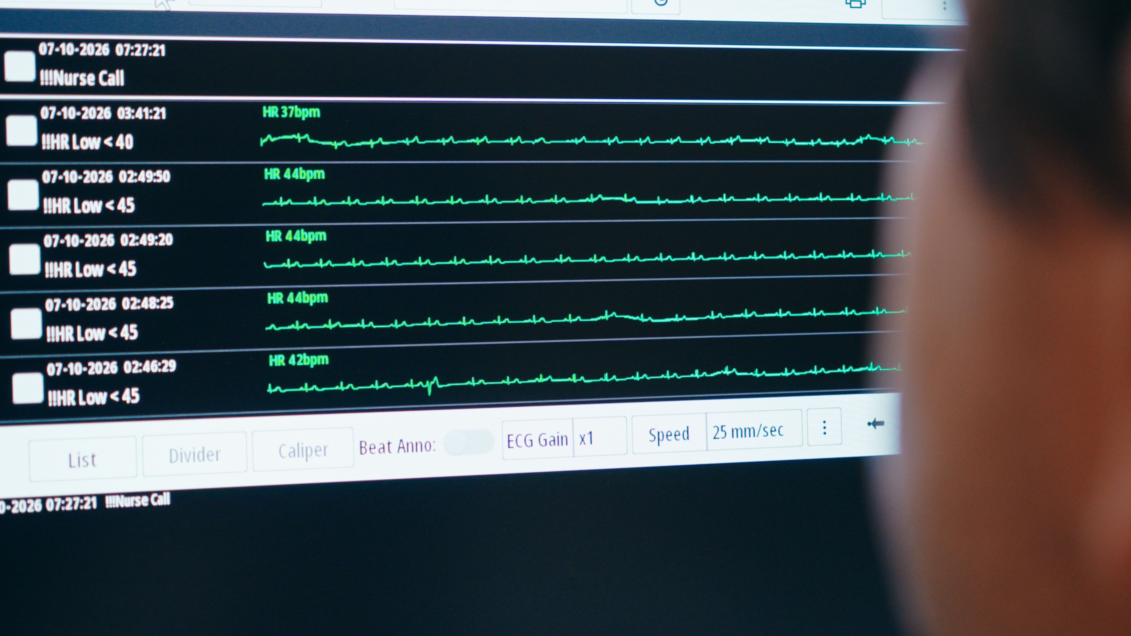 Monitor za nadzor življenjskih funkcij