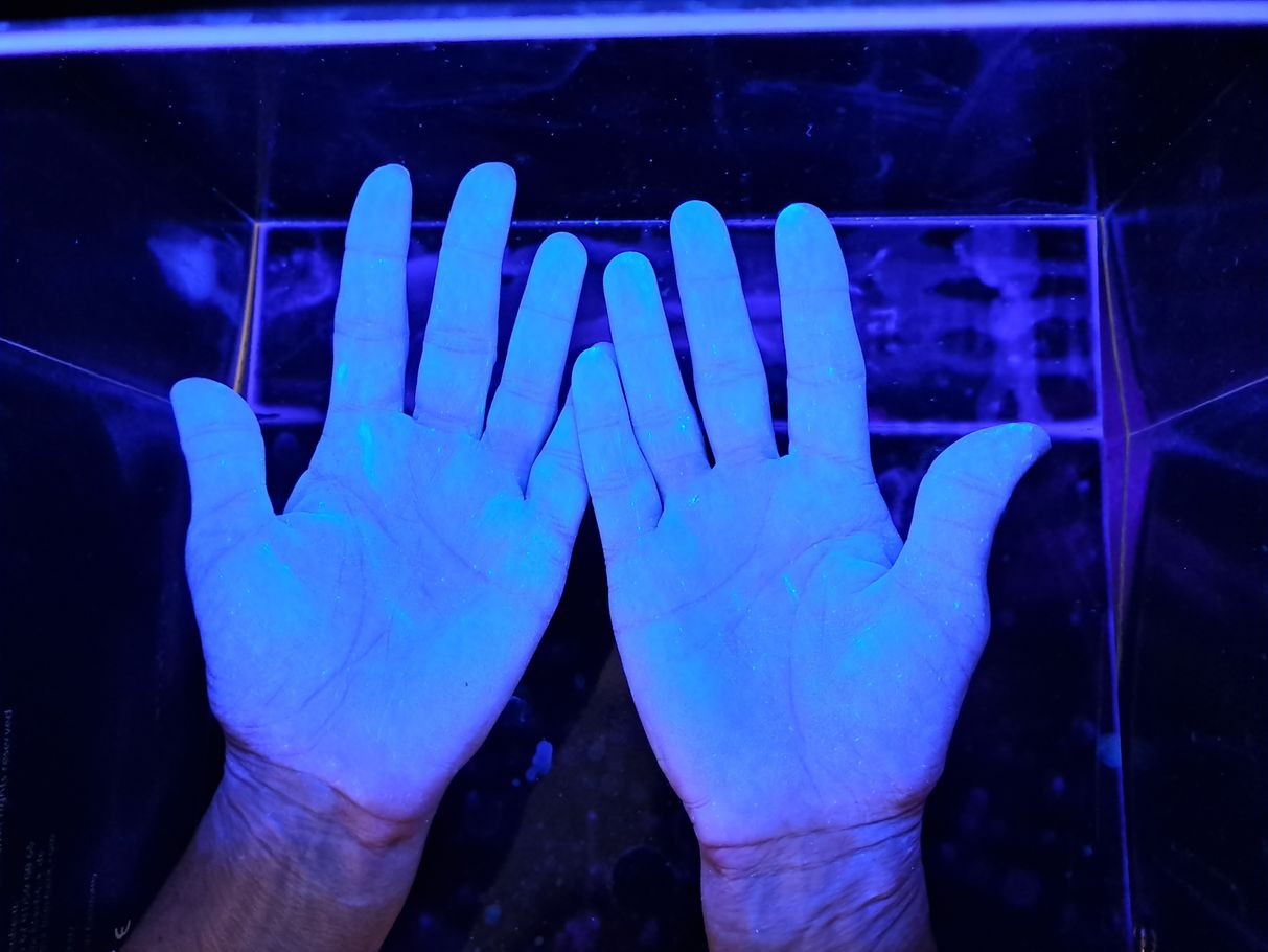 Pravilno razkužene roke.