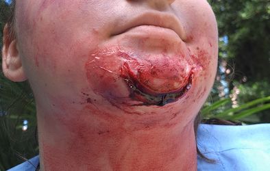 Skupna vaja SB Nova Gorica in PU Nova Gorica za ravnanje v primeru pojava življenja ogrožajočih dogodkov v zdravstveni ustanovi.