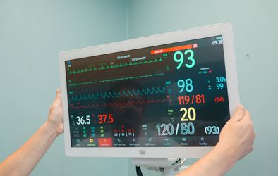 Monitor za nadzor življenjskih funkcij