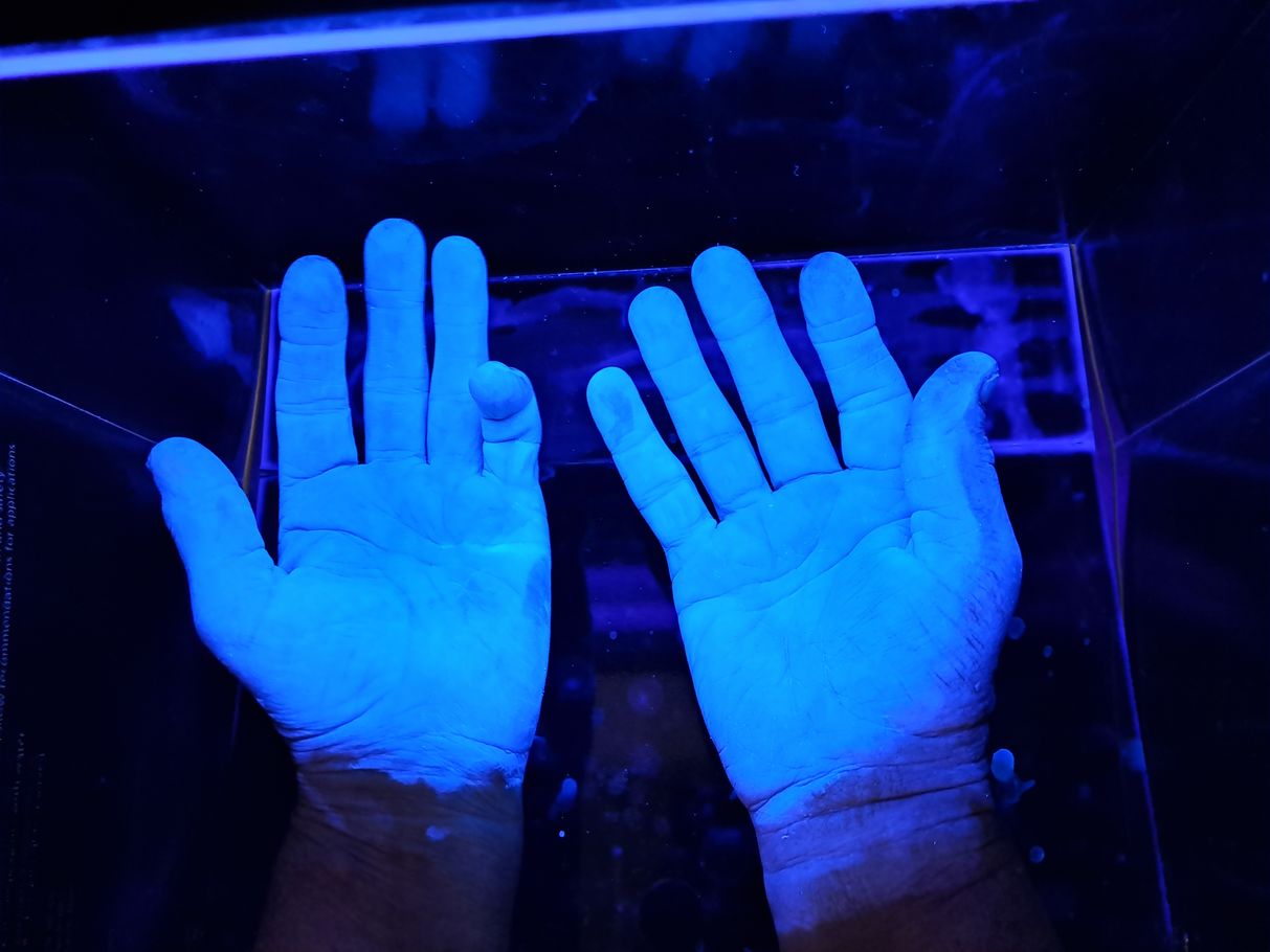 Razkužene roke pod UV svetlobo
